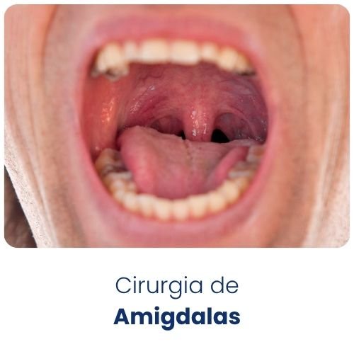 Card Cirurgia de Amigdalas