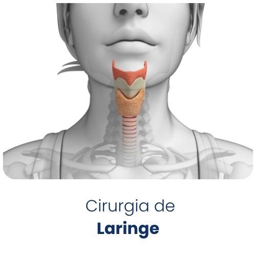 Cirurgia de Laringe
