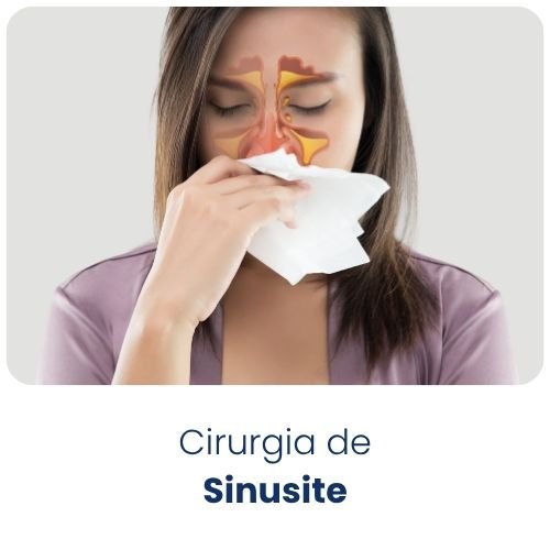 Cirurgia de Sinusite