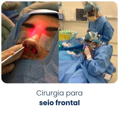 Cirurgia para seio frontal